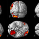 Image for article titled Scientists unlock mystery of out-of-body experiences (aka astral trips)